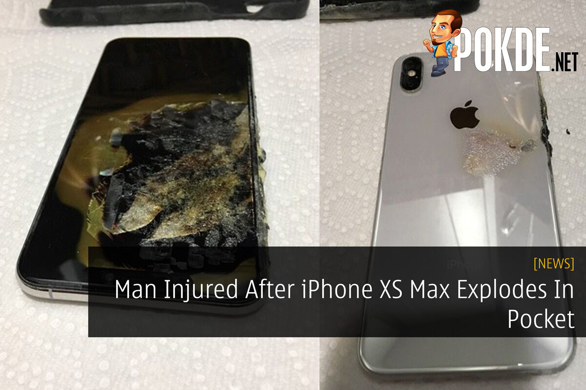 Man Injured After iPhone XS Max Explodes In Pocket 41
